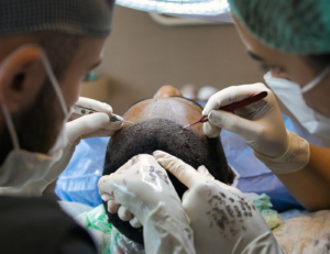 hair transplant surgery